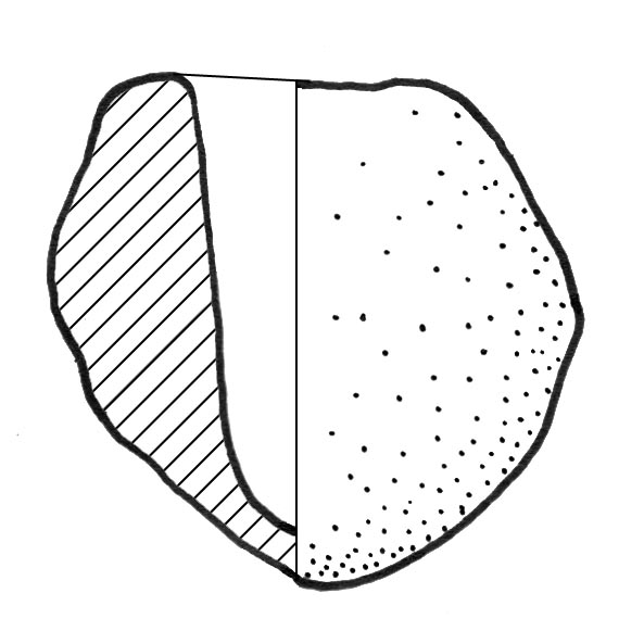 vasetto, a corpo ovoide (Eta' del bronzo)