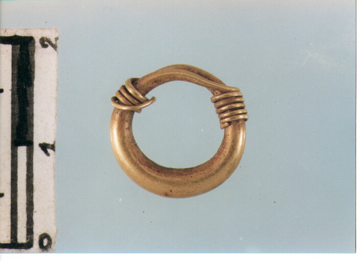 Anello crinale