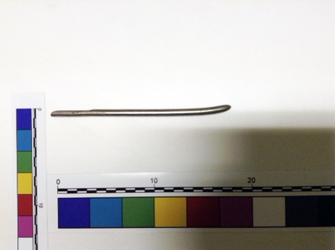 Dilatatore uterino conico con estremità appiattita (dilatatore, Strumento medico) (XX sec)