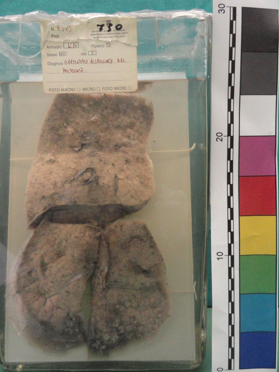 singolo reperto antropologico, preparato anatomico (seconda metà XX)