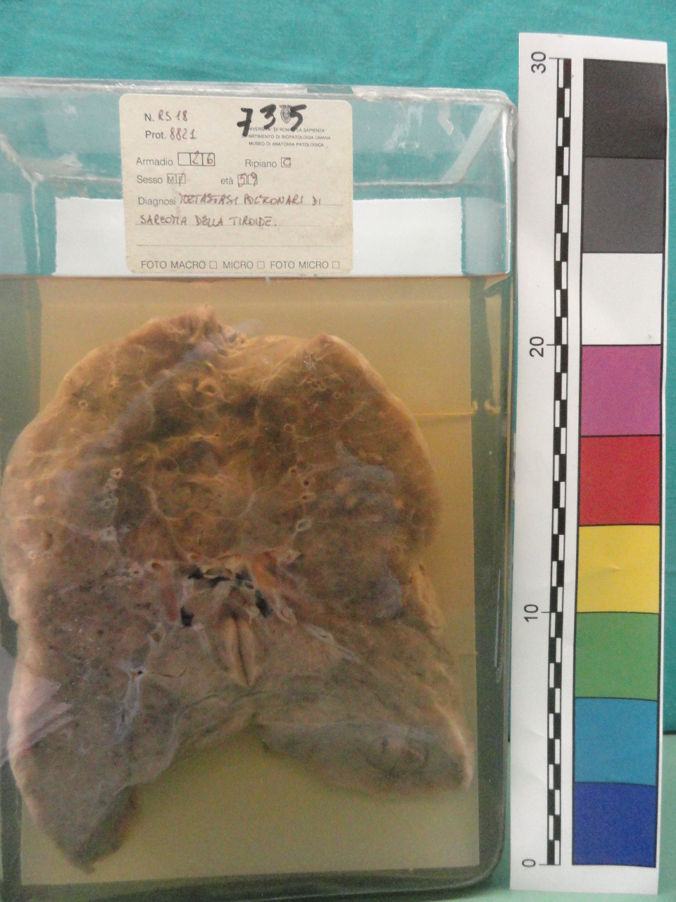 singolo reperto antropologico, preparato anatomico (seconda metà XX)