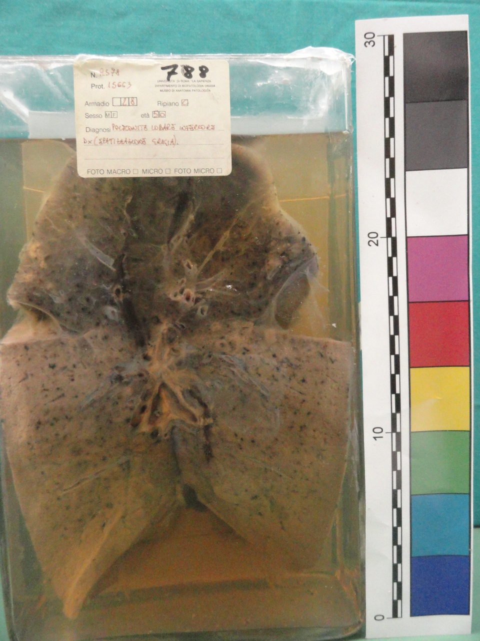 singolo reperto antropologico, preparato anatomico (seconda metà XX)