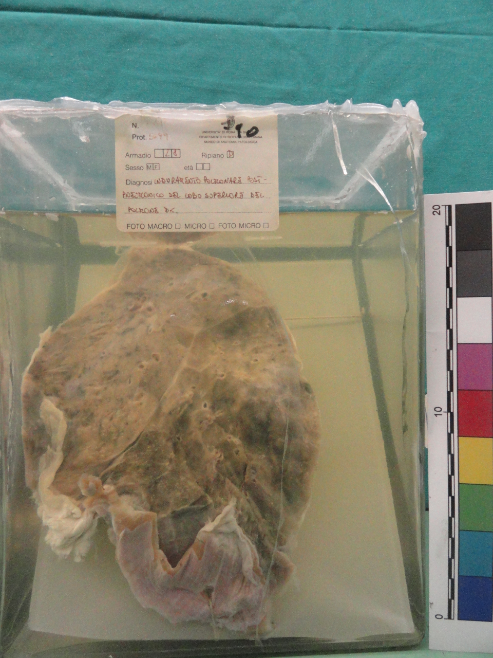 singolo reperto antropologico, preparato anatomico (seconda metà XX)