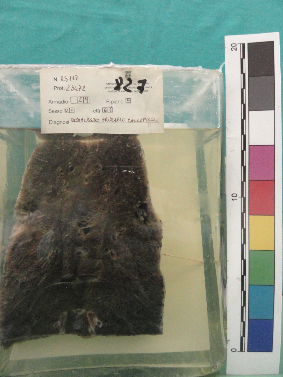 singolo reperto antropologico, preparato anatomico (seconda metà XX)