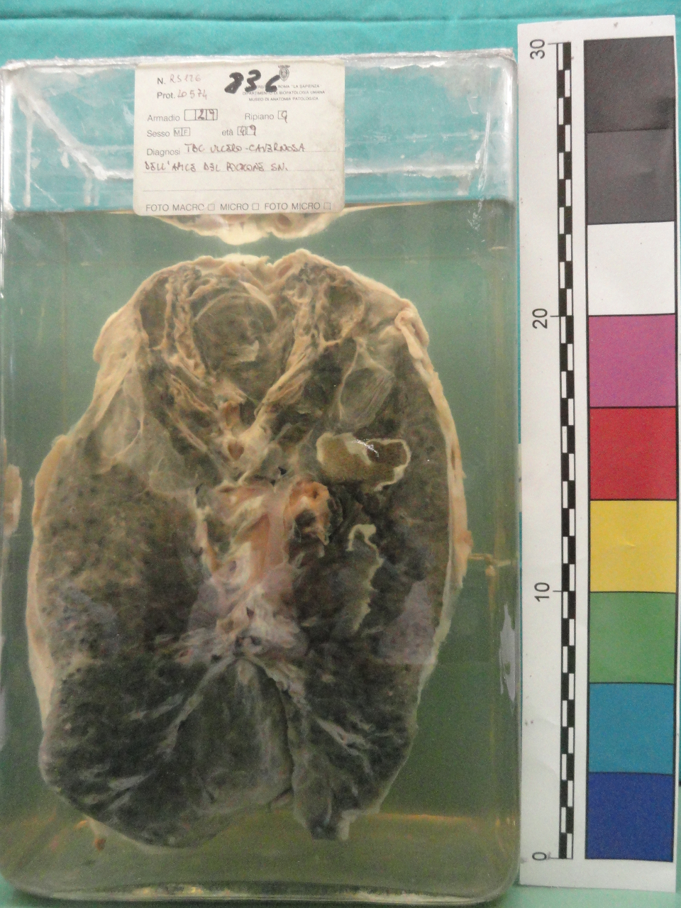 singolo reperto antropologico, preparato anatomico (seconda metà XX)