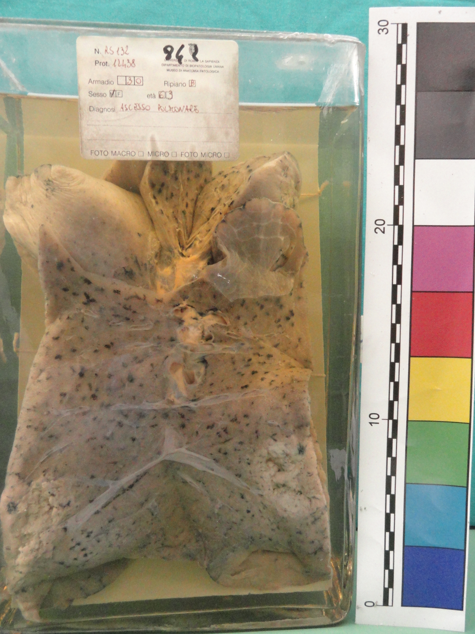 singolo reperto antropologico, preparato anatomico (seconda metà XX)