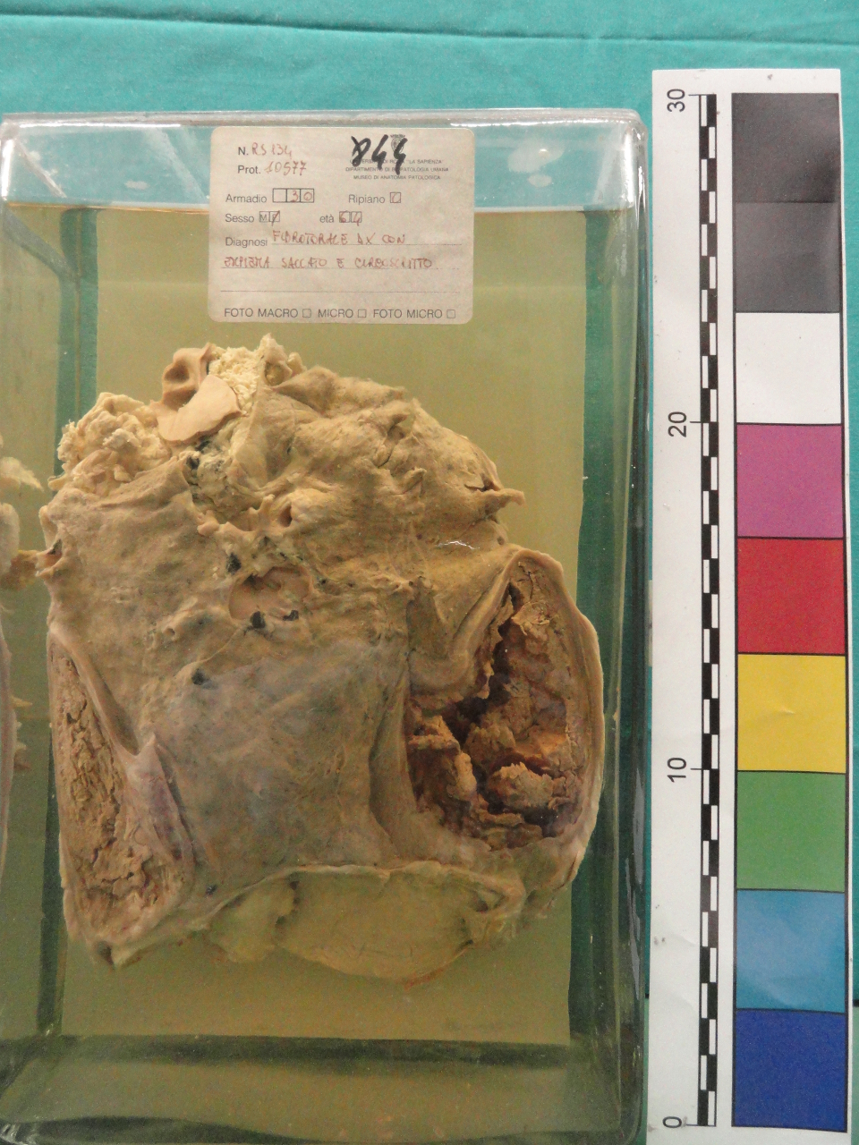 singolo reperto antropologico, preparato anatomico (seconda metà XX)