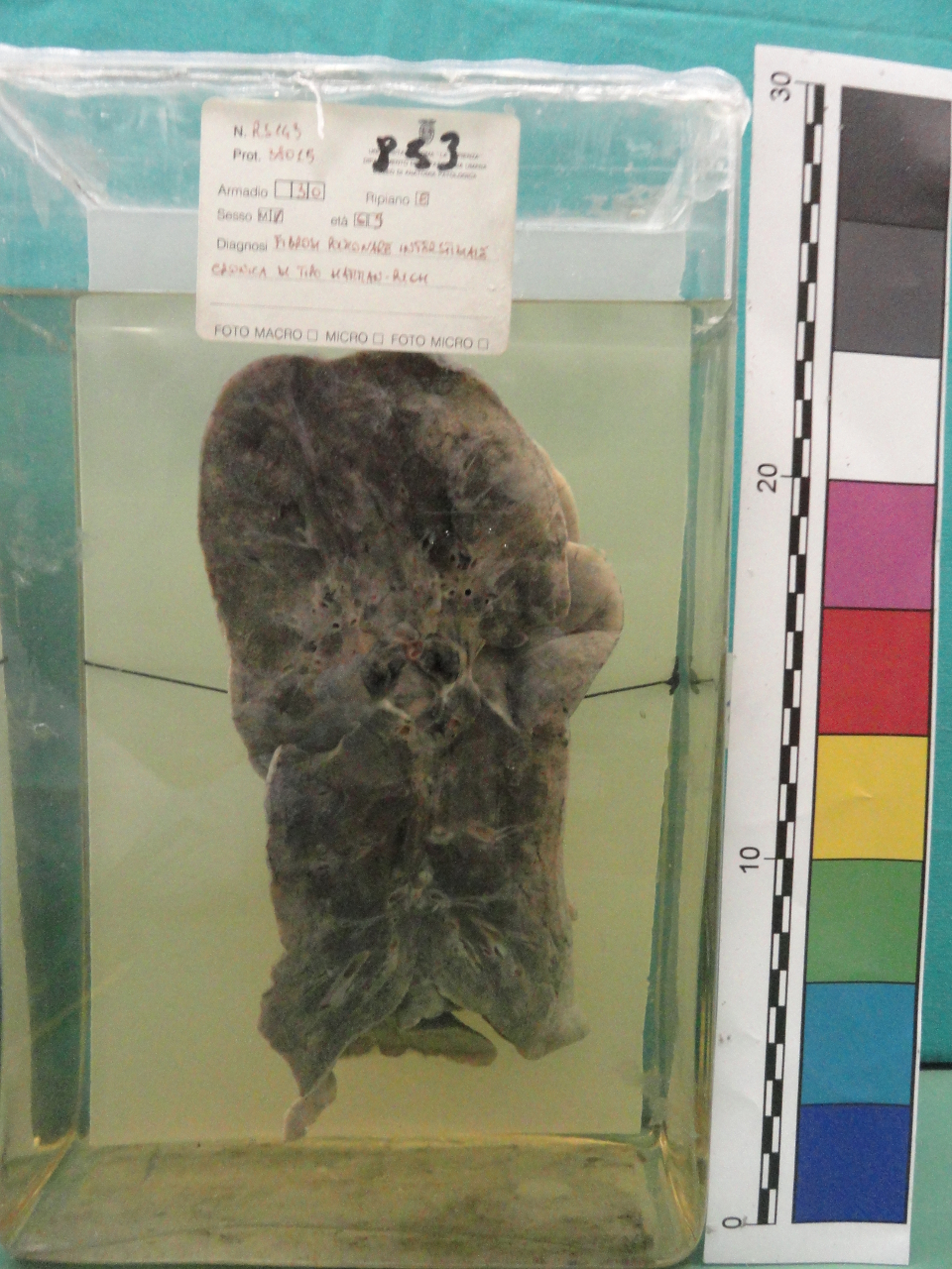 singolo reperto antropologico, preparato anatomico (seconda metà XX)