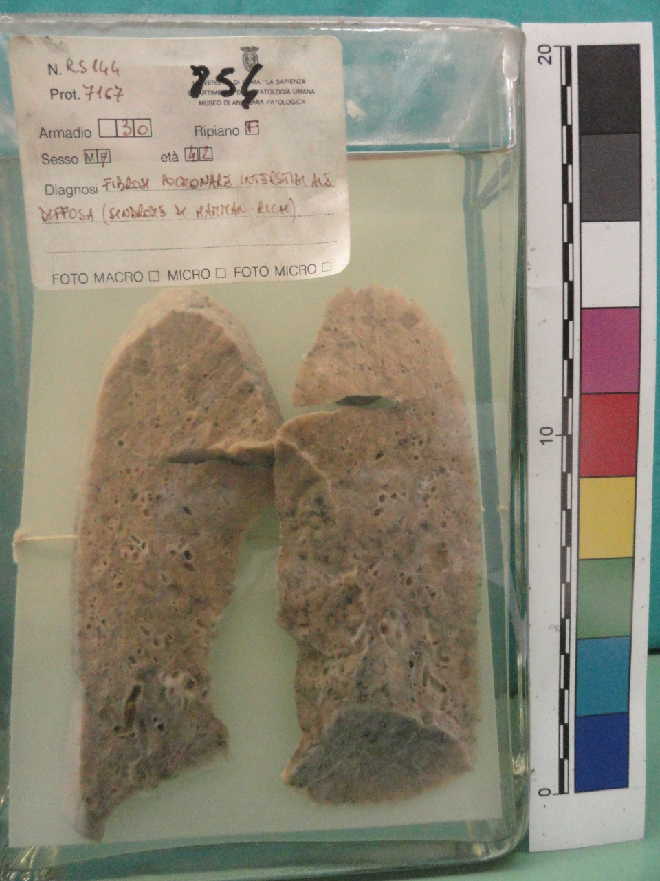 singolo reperto antropologico, preparato anatomico (seconda metà XX)