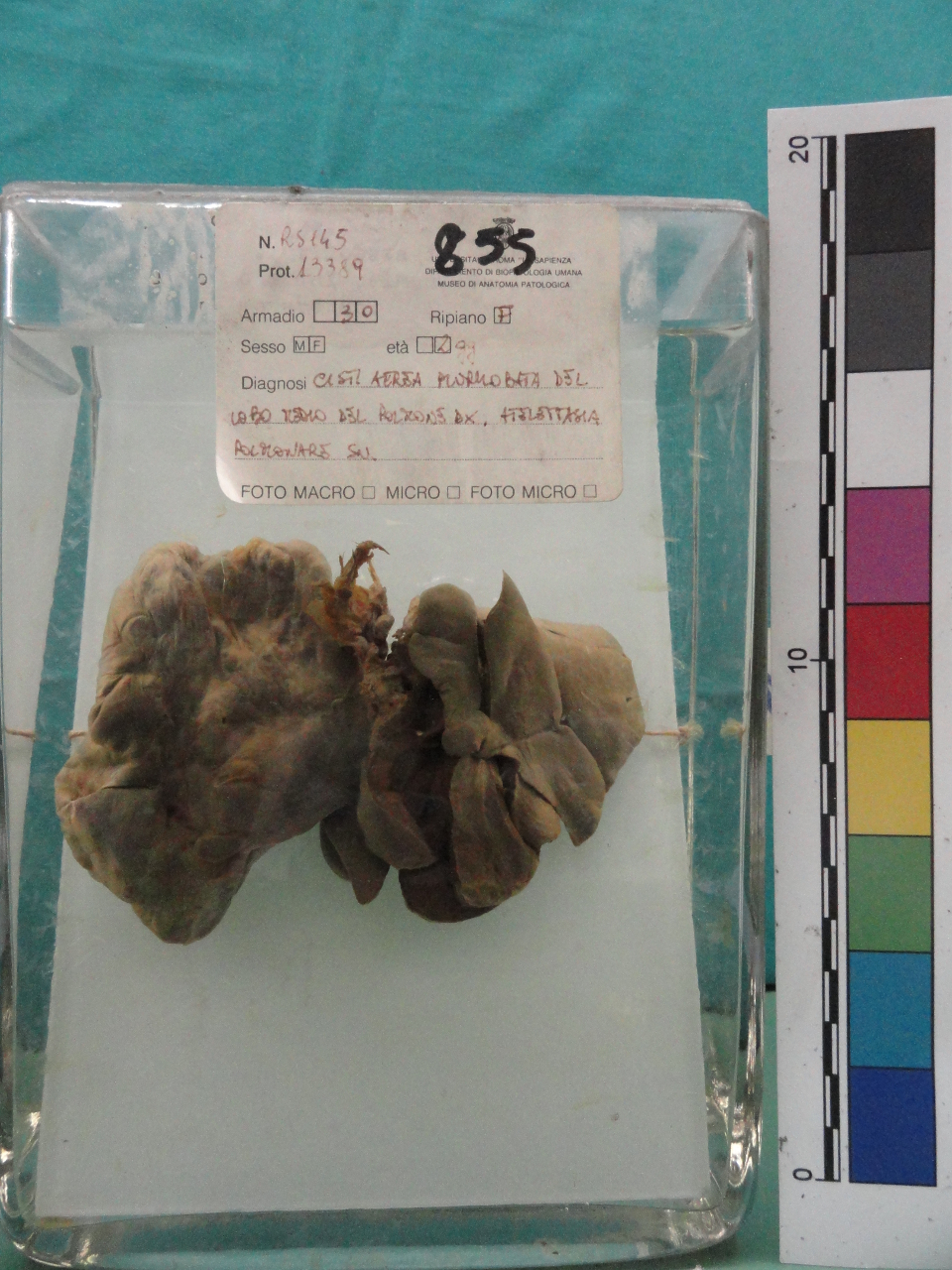 singolo reperto antropologico, preparato anatomico (seconda metà XX)