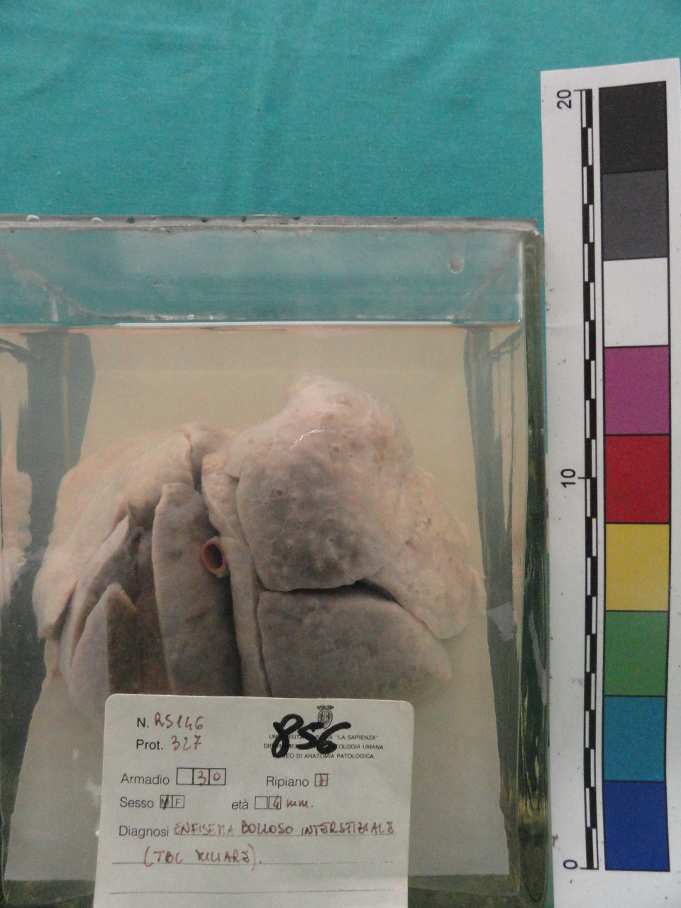 singolo reperto antropologico, preparato anatomico (seconda metà XX)