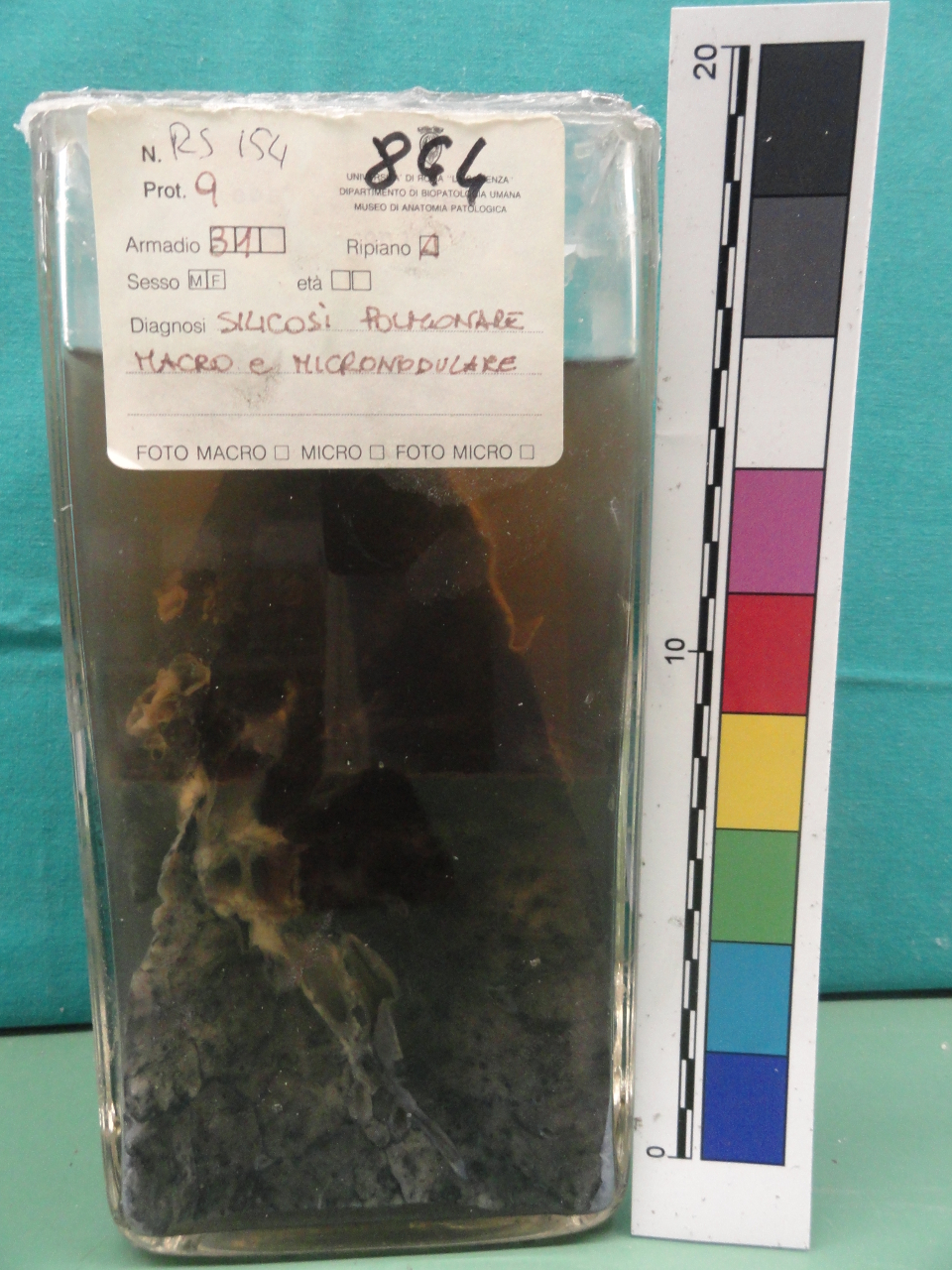 singolo reperto antropologico, preparato anatomico (seconda metà XX)