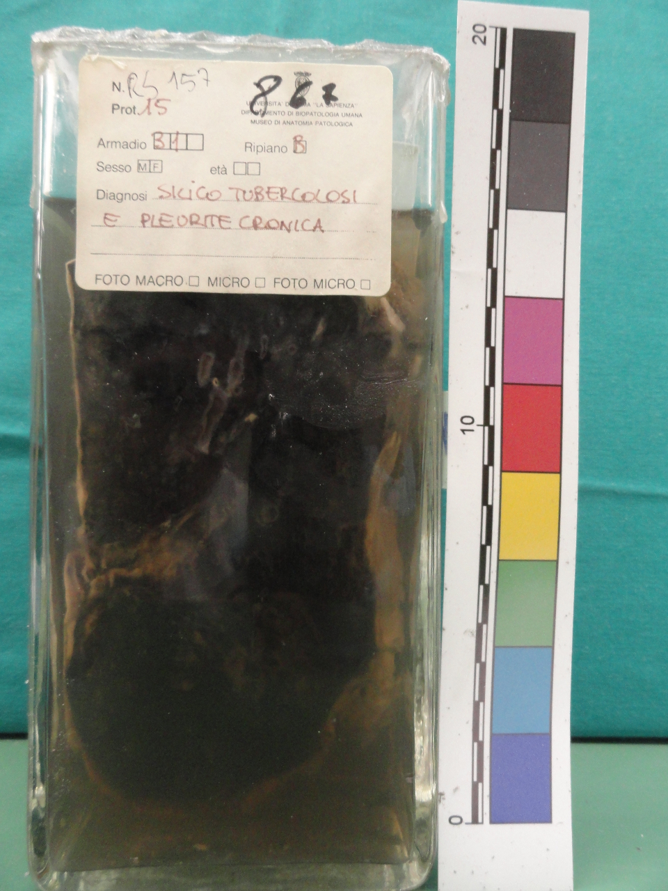 singolo reperto antropologico, preparato anatomico (seconda metà XX)