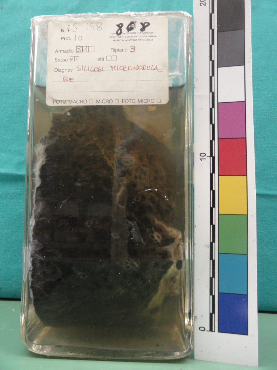 singolo reperto antropologico, preparato anatomico (seconda metà XX)