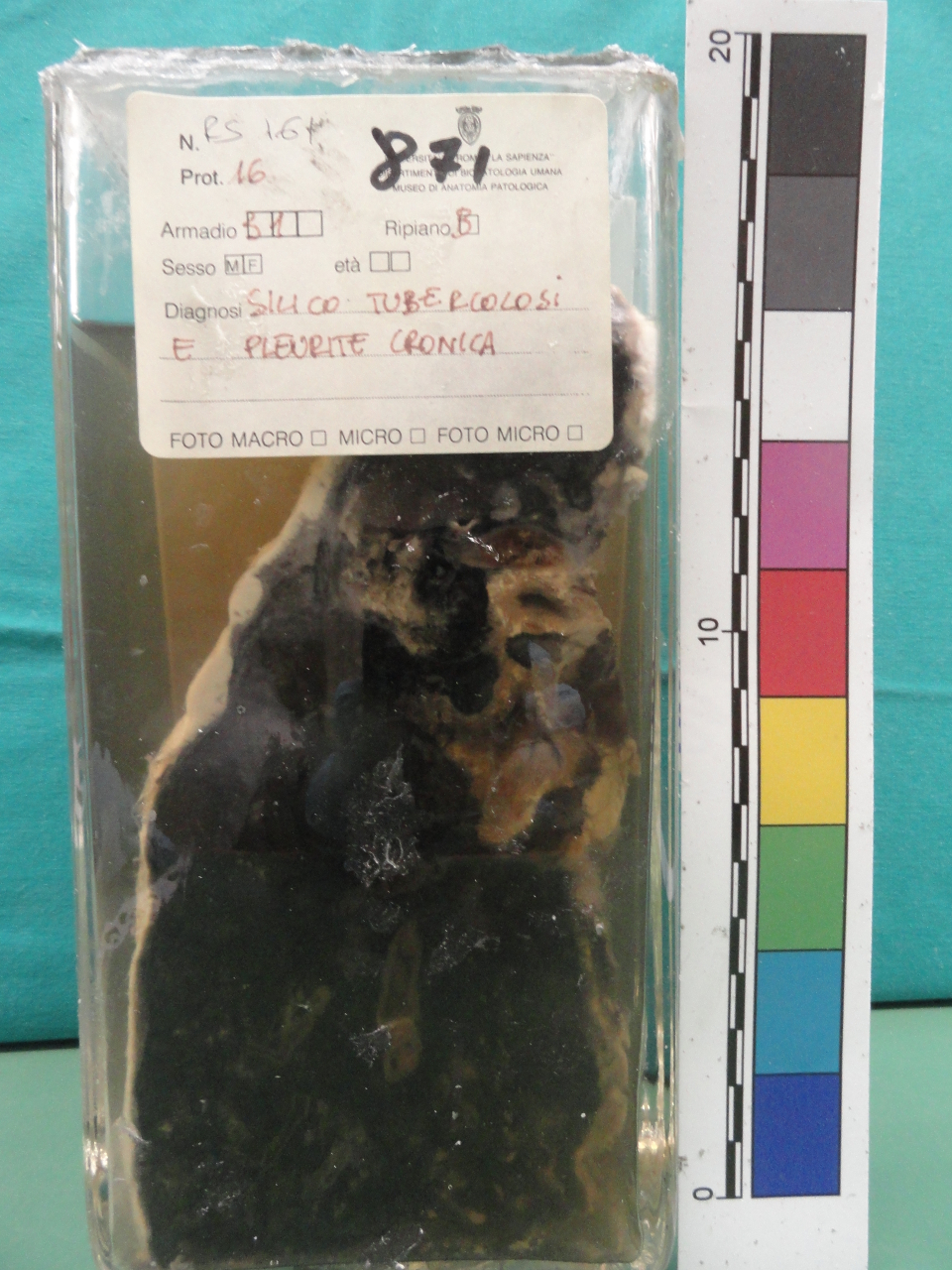 singolo reperto antropologico, preparato anatomico (seconda metà XX)