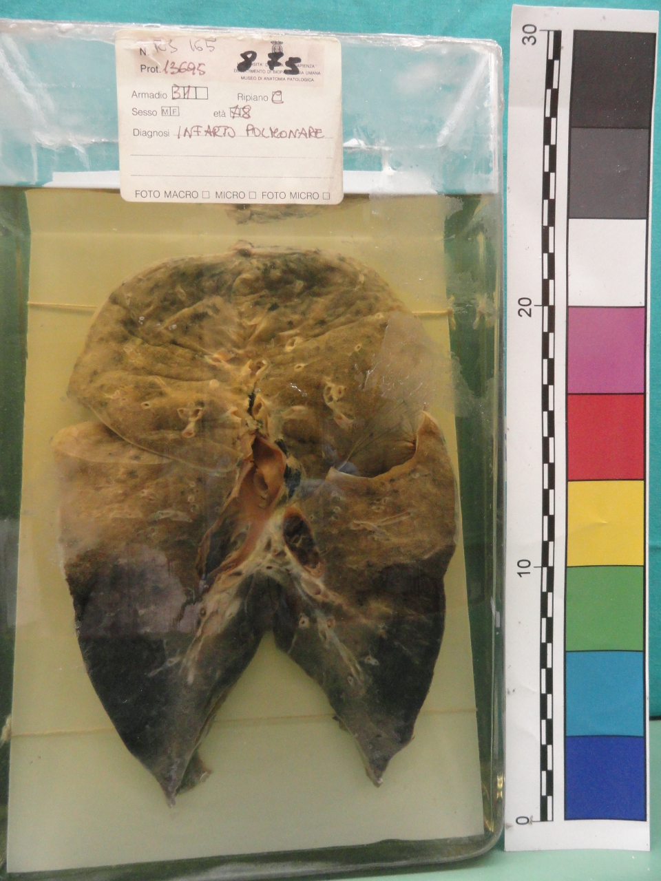 singolo reperto antropologico, preparato anatomico (seconda metà XX)