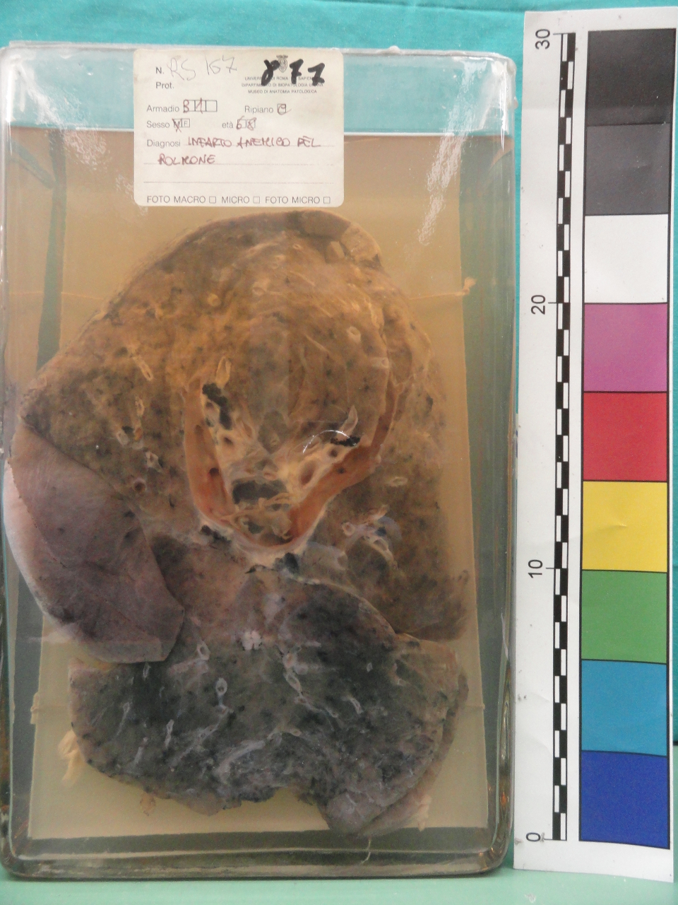 singolo reperto antropologico, preparato anatomico (seconda metà XX)