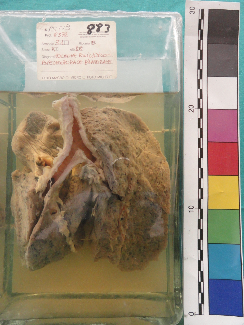 singolo reperto antropologico, preparato anatomico (seconda metà XX)