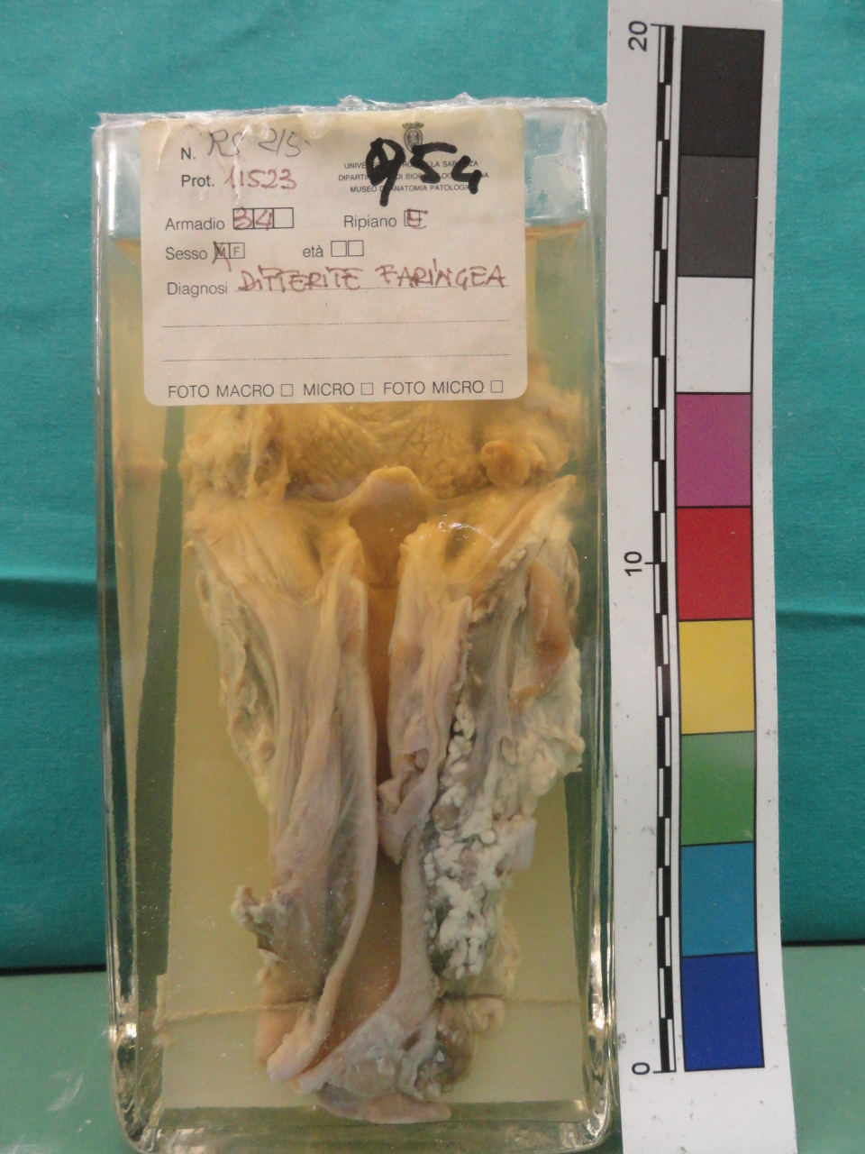 singolo reperto antropologico, preparato anatomico (seconda metà XX)