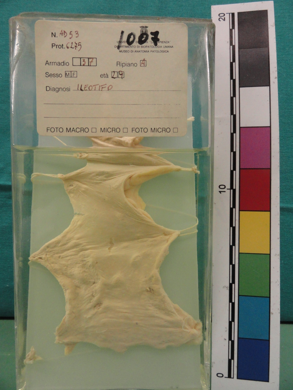 singolo reperto antropologico, preparato anatomico (seconda metà XX)