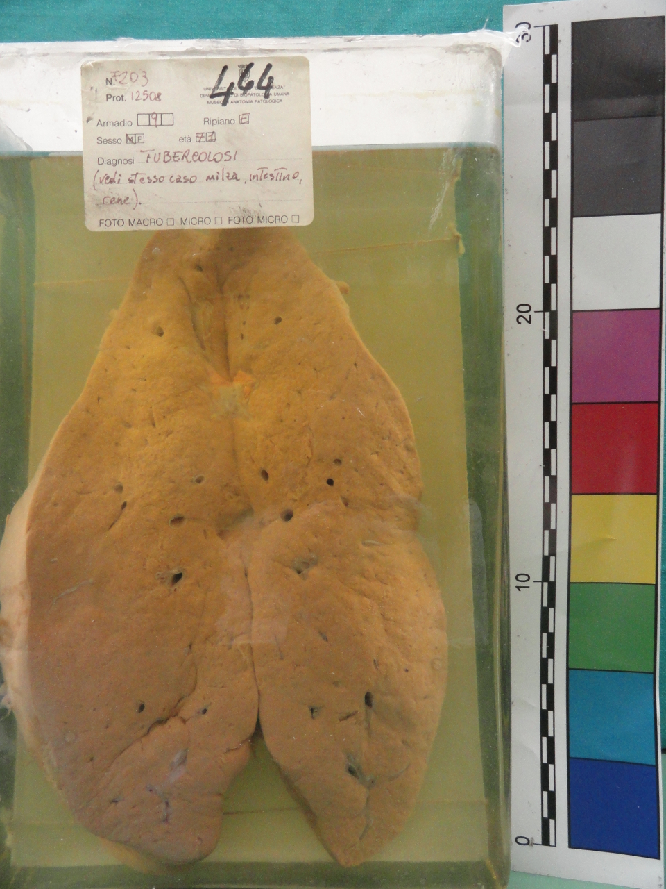 singolo reperto antropologico, preparato anatomico (seconda metà XX)