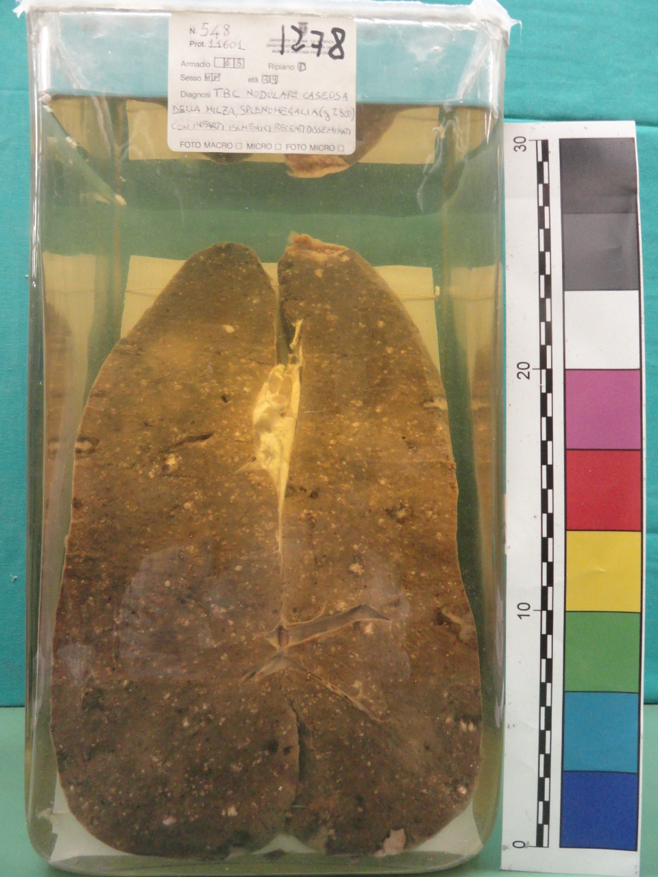 singolo reperto antropologico, preparato anatomico (seconda metà XX)