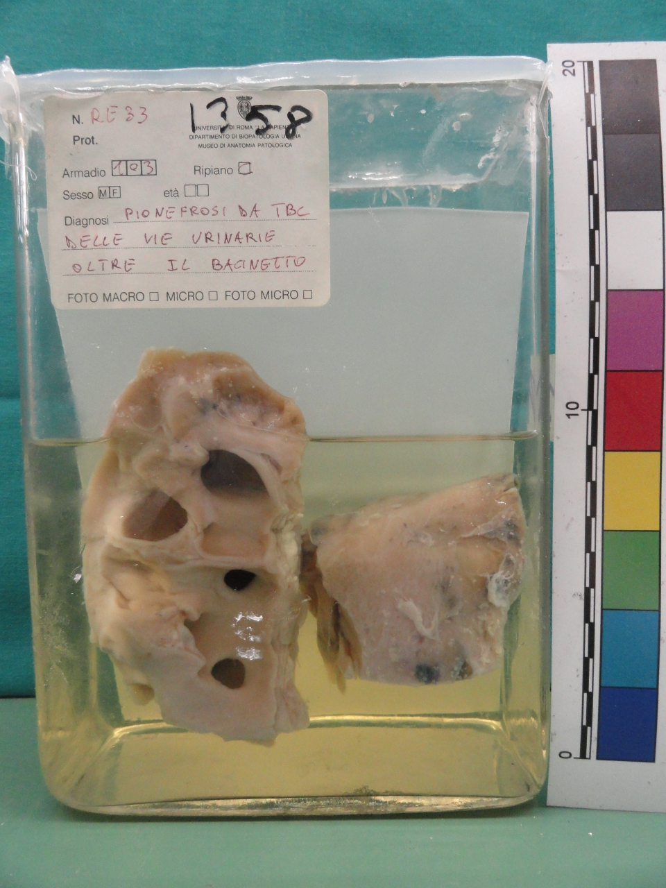 singolo reperto antropologico, preparato anatomico (seconda metà XX)