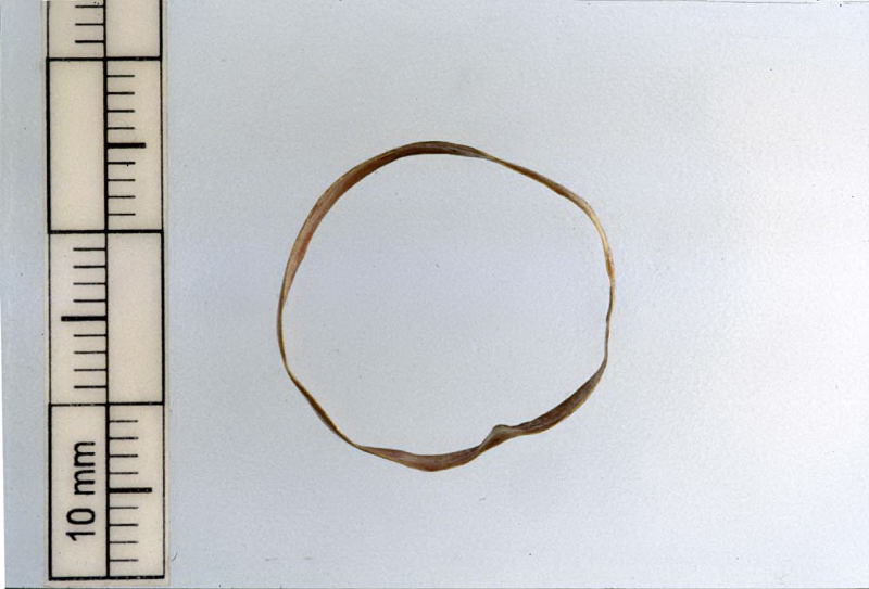 anello a fascia (V sec. a.C./ IV sec. a.C)