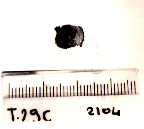 bottone - Cultura Ligure della Prima Età del Ferro (VII a.C)