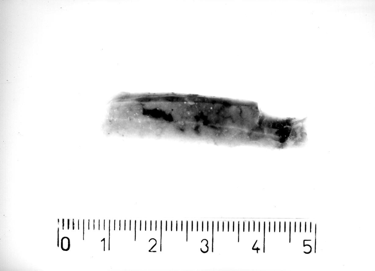 troncatura obliqua (Neolitico)