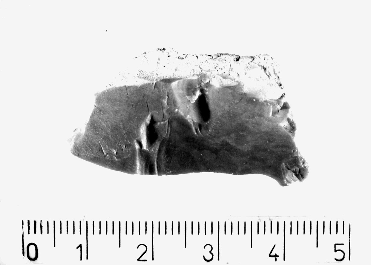 bulino a stacco laterale su troncatura obliqua (Neolitico)