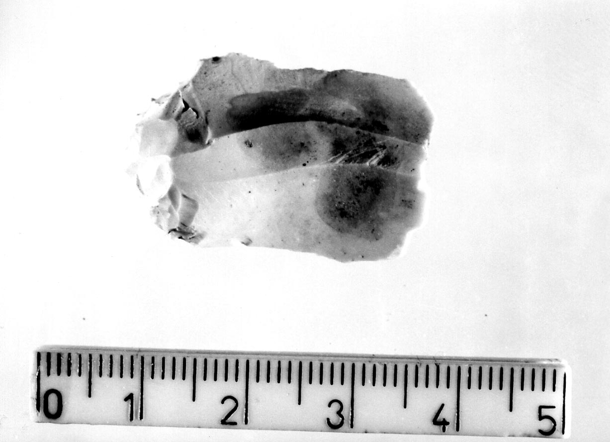 grattatoio frontale lungo/ frammento (Neolitico)