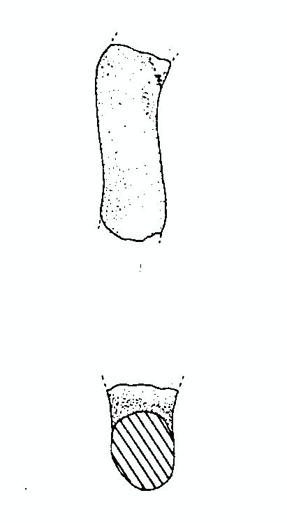 vaso/ ansa - appenninico (inizio età del Ferro)