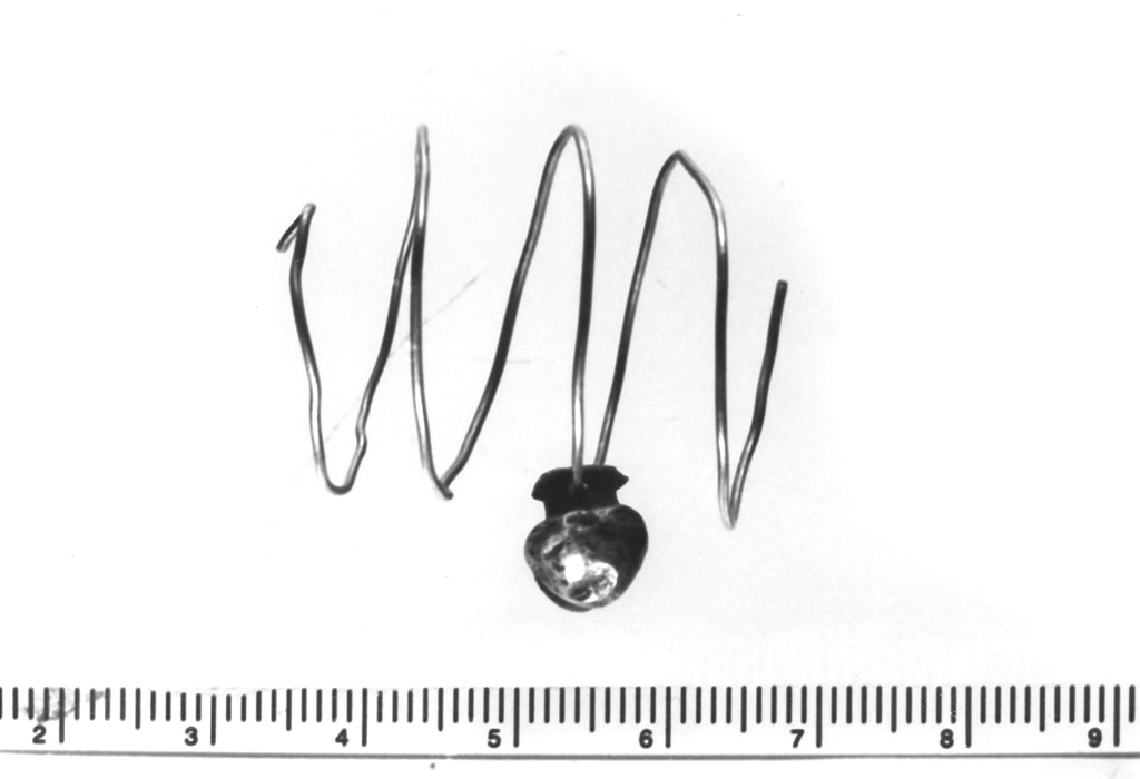 fermatrecce (sec. VI a.C)