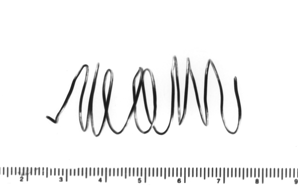 fermatrecce (sec. VI a.C)