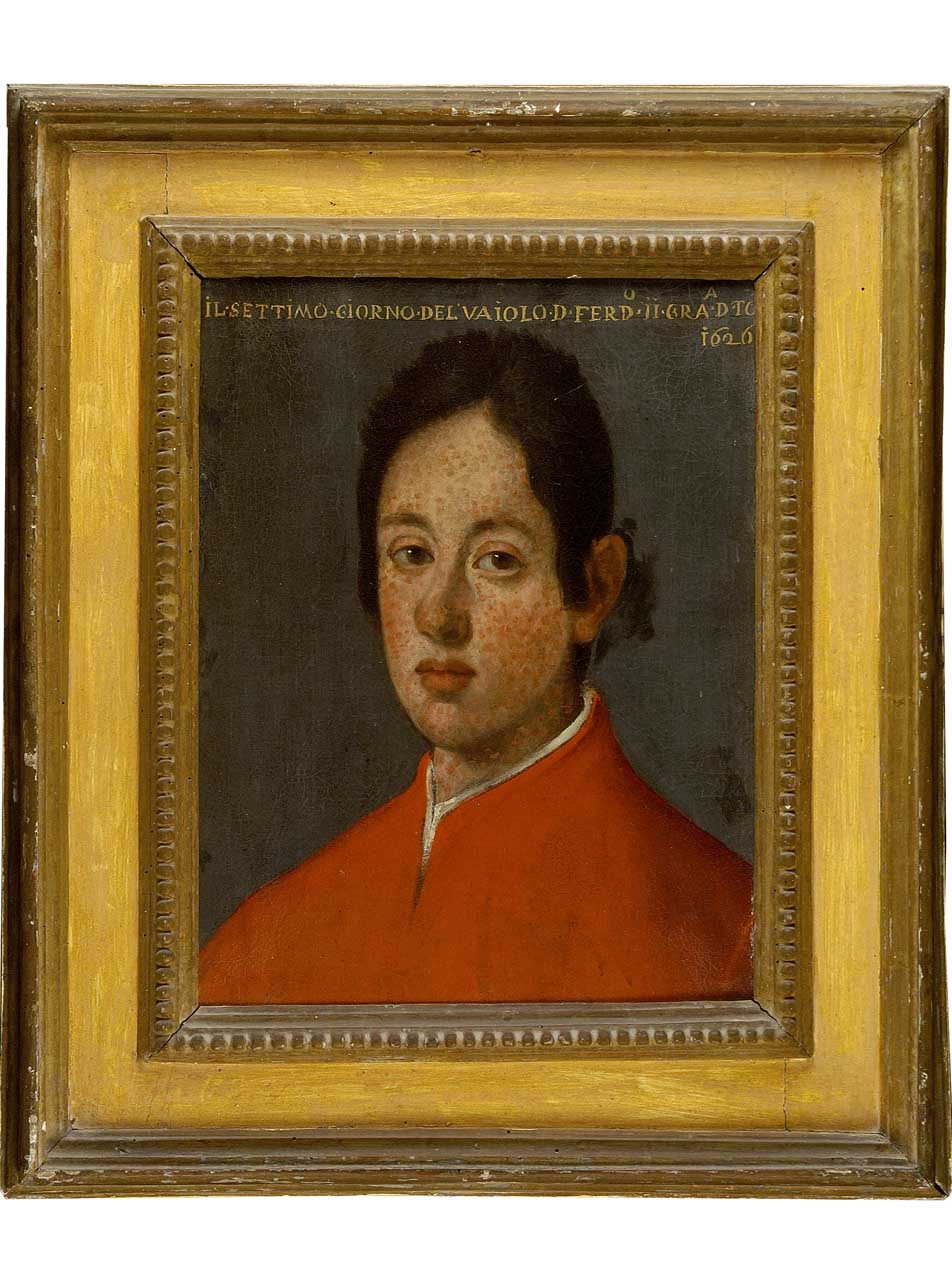 ritratto di Ferdinando II al settimo giorno di vaiolo (dipinto) di Suttermans Giusto (sec. XVII) 