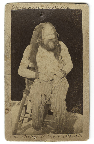 Persone - Uomini - Lombroso - Morselli - (positivo) di Balelli, Licurgo, Morselli, Enrico (ultimo quarto XIX)