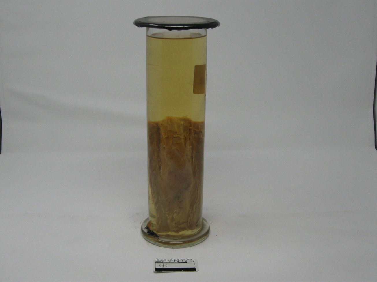 singolo reperto antropologico, reperto osseo (morfologia alterata per patologia) (XIX-XX)