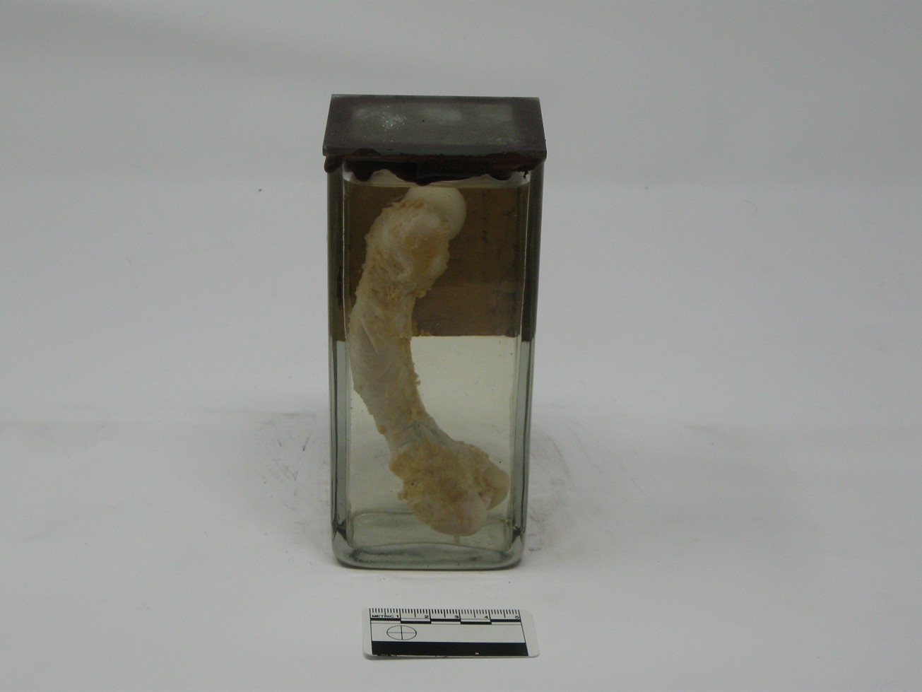 singolo reperto antropologico, reperto osseo (morfologia alterata per patologia) (XIX-XX)