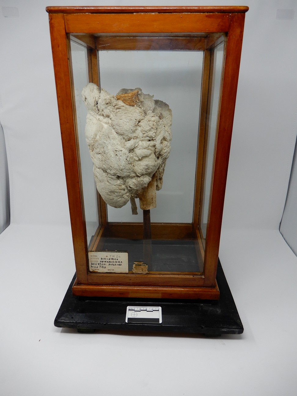 singolo reperto antropologico, reperto osseo (morfologia alterata per patologia) (XIX-XX)