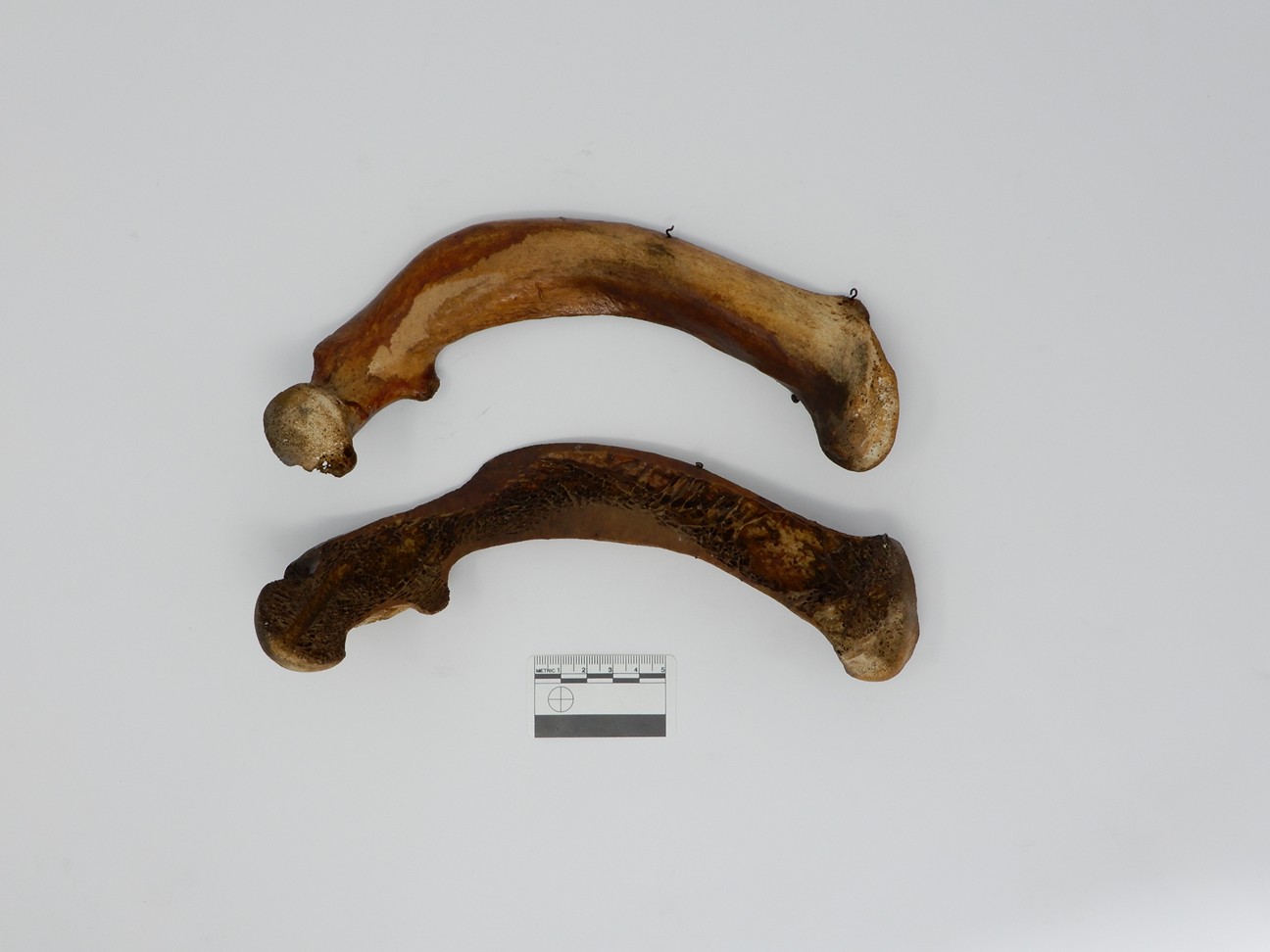 singolo reperto antropologico, reperto osseo (morfologia alterata per patologia) (XIX-XX)