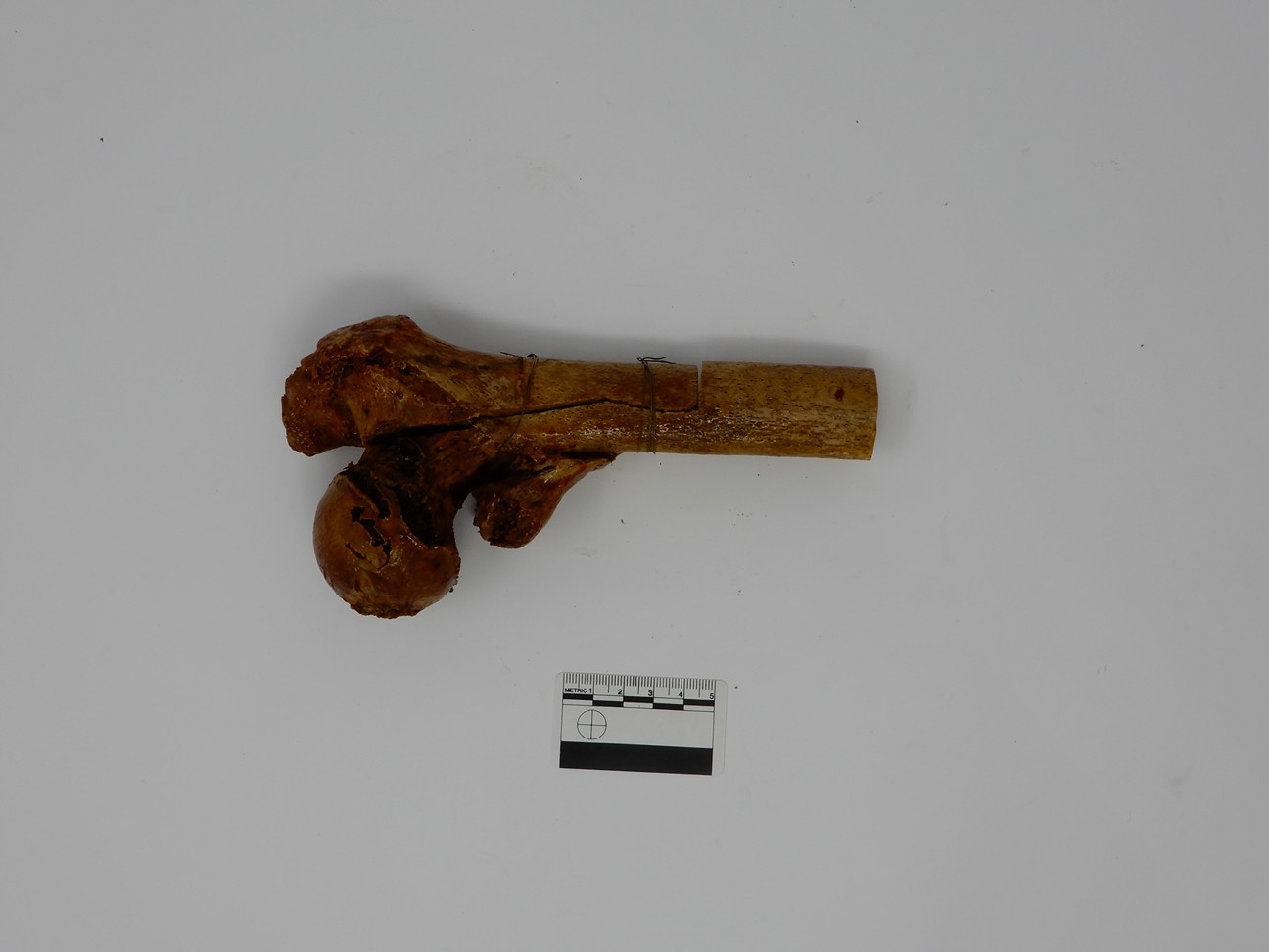 singolo reperto antropologico, reperto osseo (morfologia alterata per patologia) (XIX-XX)