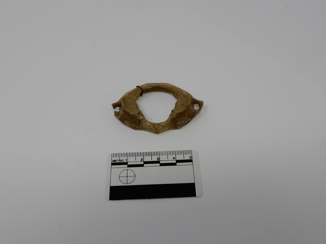 singolo reperto antropologico, reperto osseo (morfologia alterata per patologia) (XIX-XX)