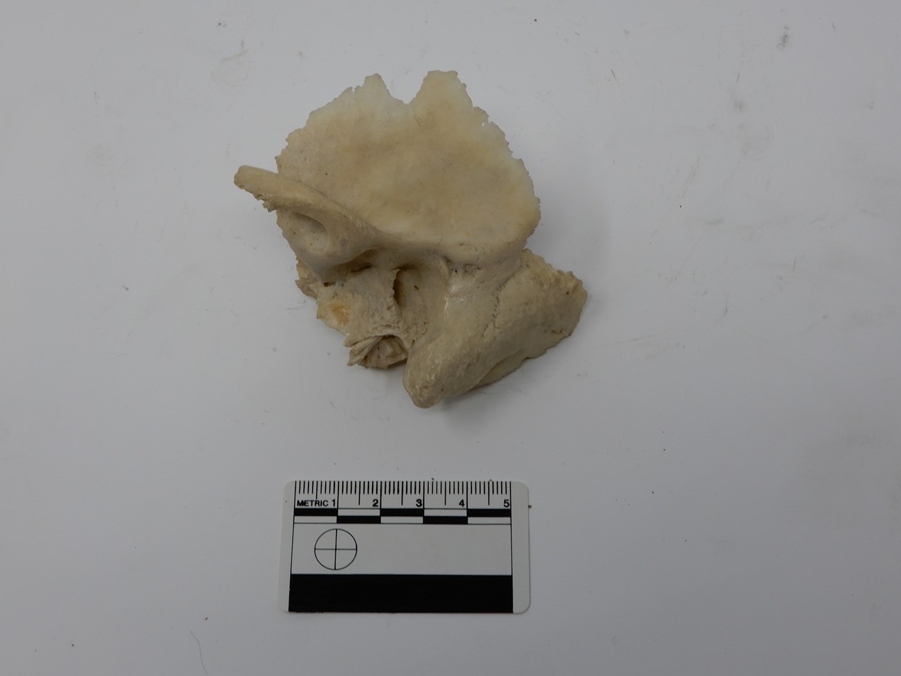 singolo reperto antropologico, reperto osseo (morfologia alterata per patologia) (XIX-XX)