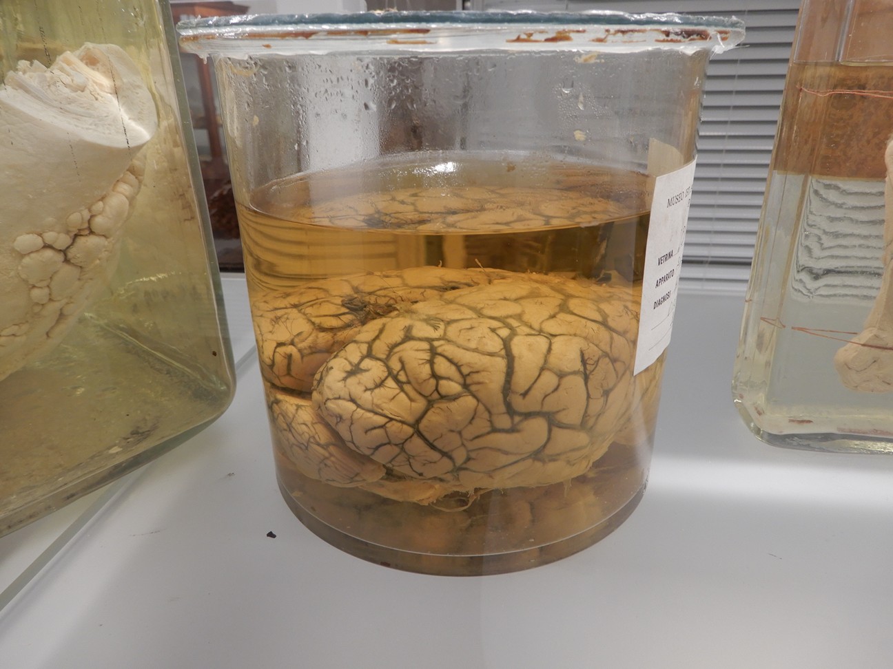 singolo reperto antropologico, preparato anatomico (morfologia alterata per patologia) (XIX-XX)