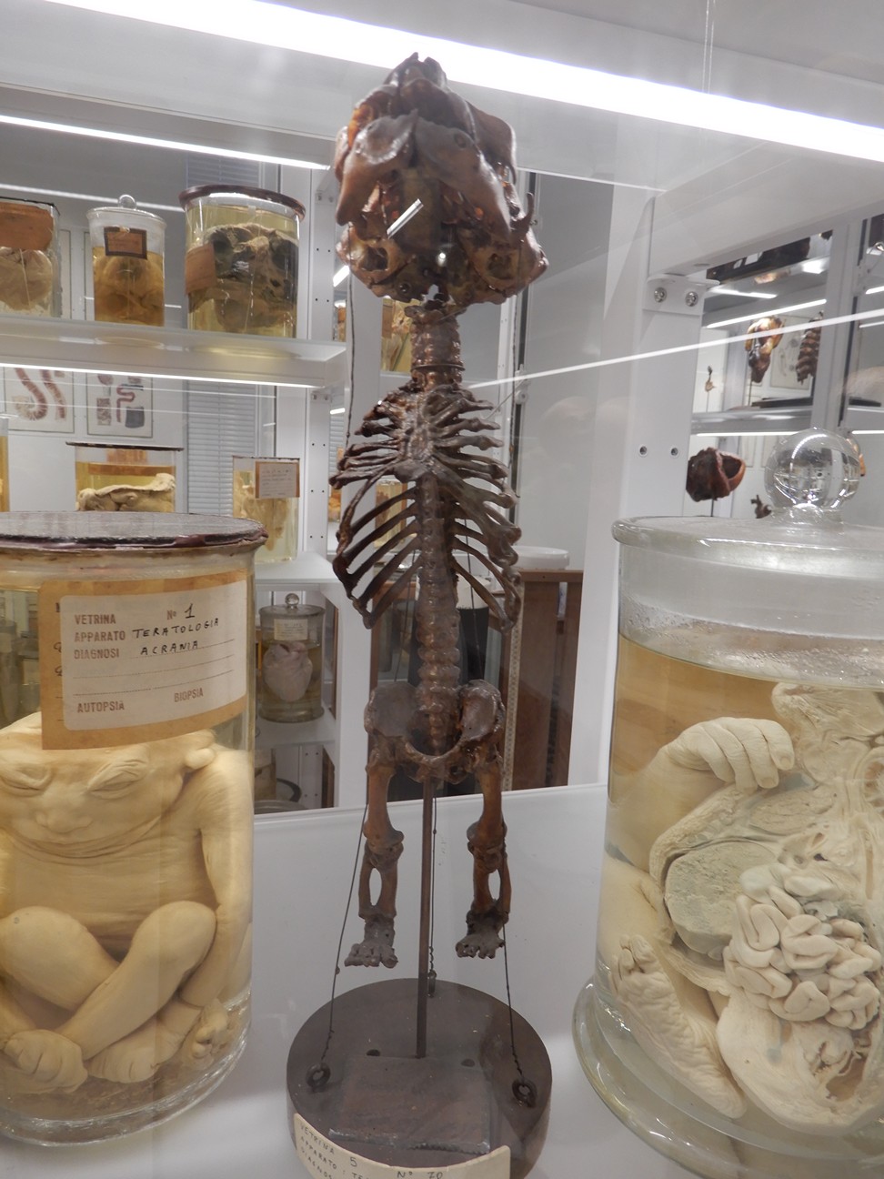 singolo reperto antropologico, preparato anatomico (morfologia alterata per patologia) (XIX-XX)