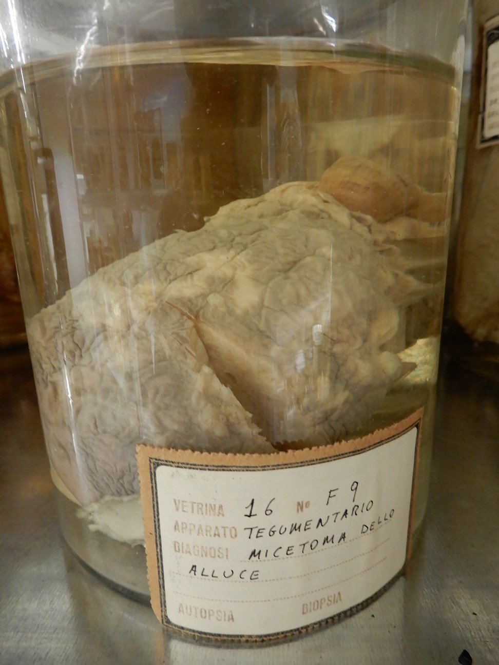 singolo reperto antropologico, preparato anatomico (morfologia alterata per patologia) (XIX-XX)