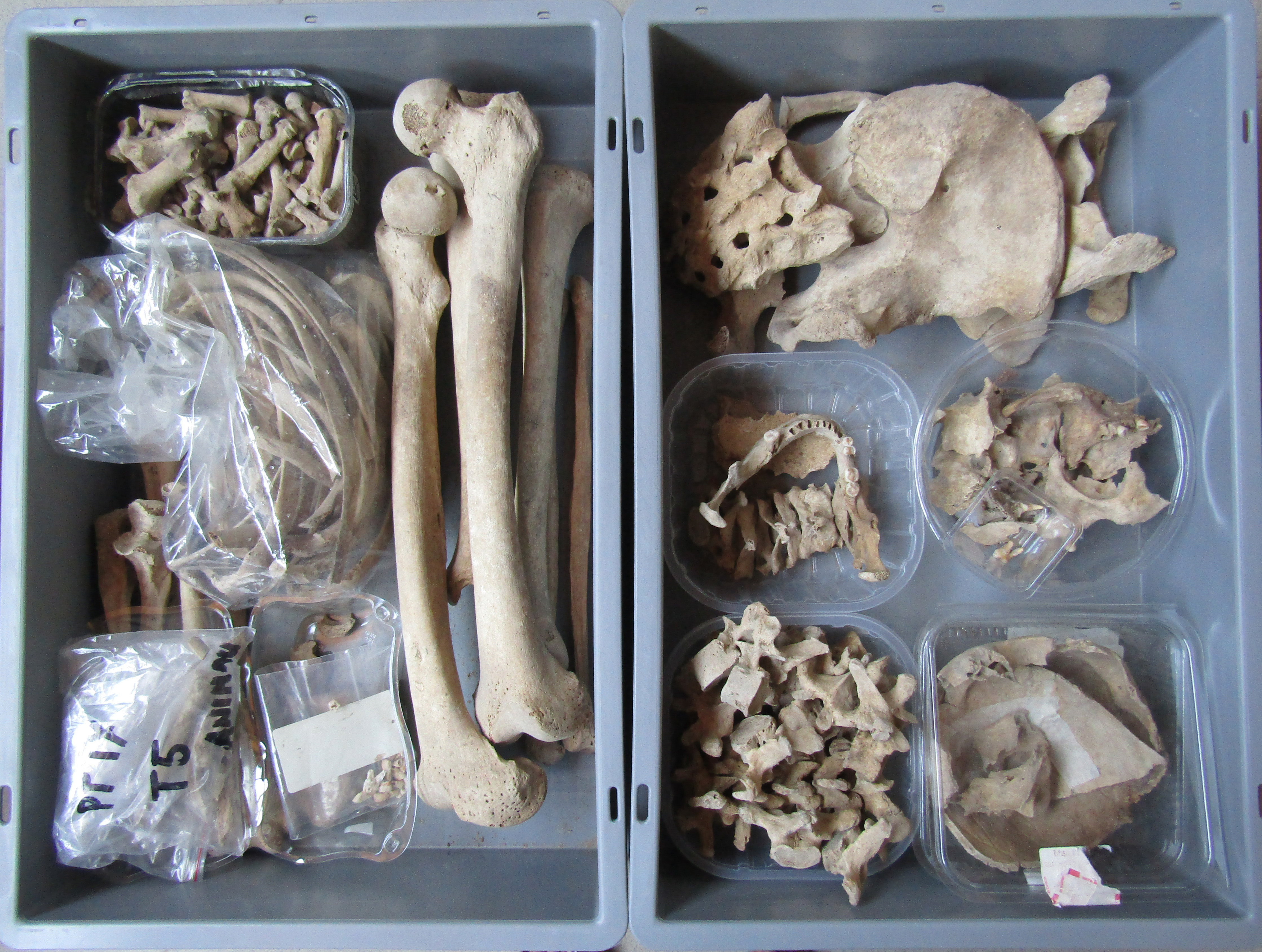 reperti antropologici pertinenti a un unico individuo, reperto osteo-dentario (morfologia naturale, inumato) (SECOLI/ VIII)