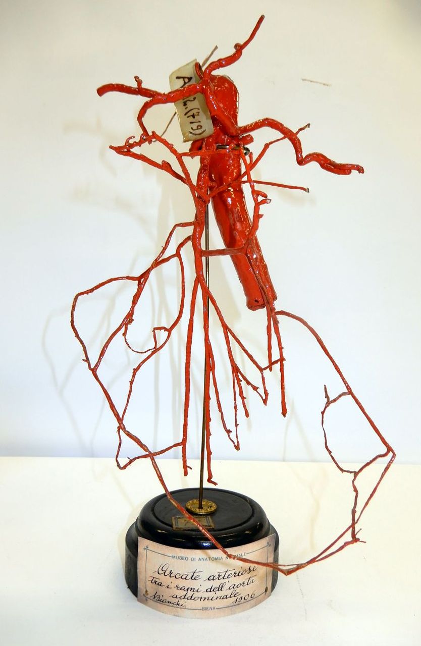 singolo reperto antropologico, preparato anatomico (apparato circolatorio) (morfologia/ struttura alterata post mortem per intervento antropico, trattato e colorato) (XX)