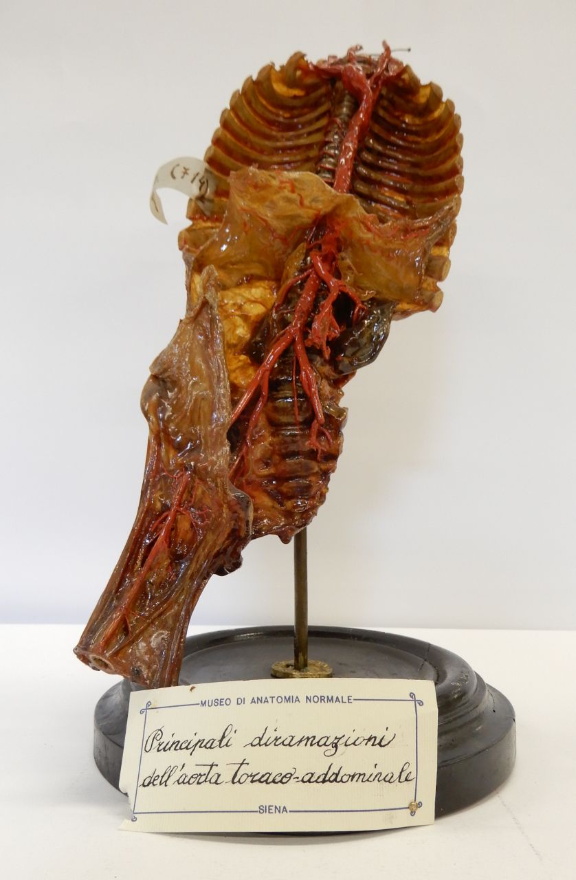 singolo reperto antropologico, preparato anatomico (apparato circolatorio) (morfologia/ struttura alterata post mortem per intervento antropico, trattato e colorato) (ultimo quarto XIX)